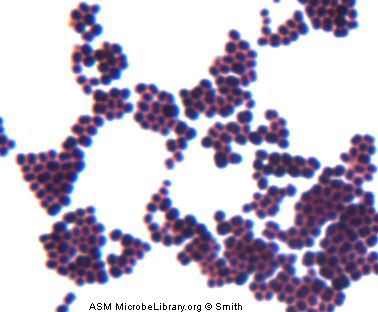 staphylococcus gram stain image