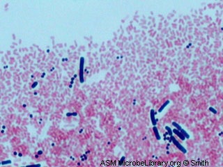 bacteria image