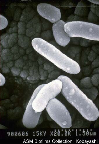 bacteria in infected lung
