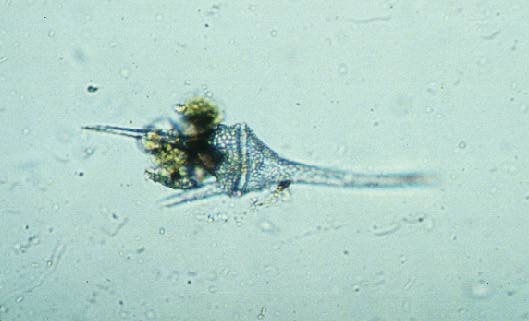 Dinoflagellate algae