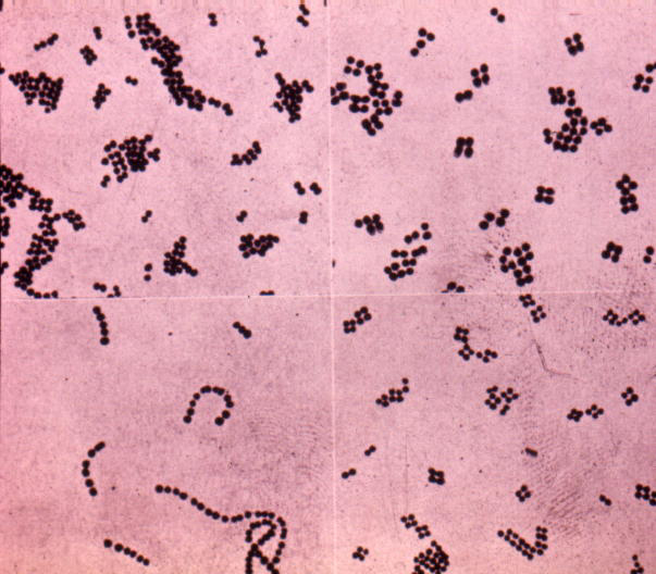 Streptococcus Gram Stain